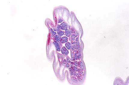 (A) Female worm showing Wolbachia staining in the lateral