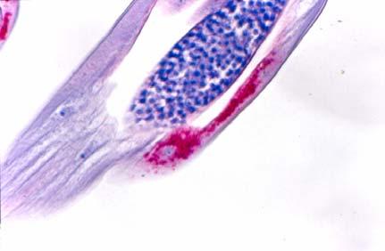 (B) Male worm showing Wolbachia staining in the lateral chord.