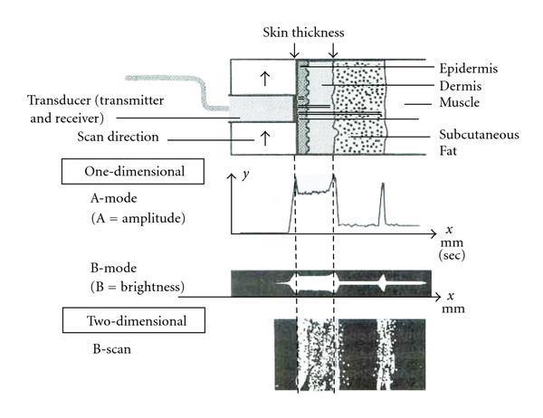 The analytical methods Figure 19: Principle of B-scan sonographic image acquisition from skin.