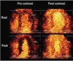 Ultrasound Applications This kind of imaging is considered quite