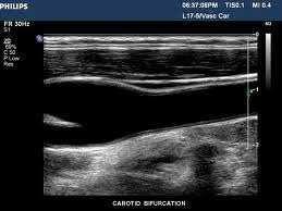 Cardiology The use of ultrasound in cardiology is known as