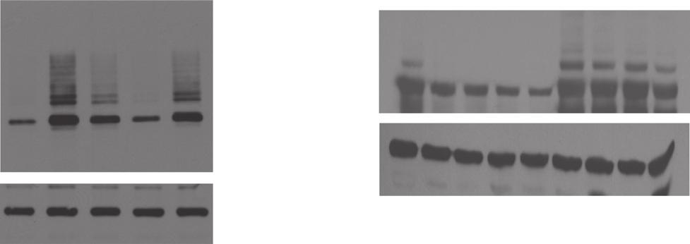 ) sirl Si-PHD2 ) Wt-HIF1α(μg) Wt-Ubi Foxp3 1 2 2 _ + + + + + + + + + HiF-1α(μg) Foxp3 mock treatment Proteasome inhibitor.5 1 2 3 1 2 3 + + + + + + + + + W: anti-tubulin W: anti-tubulin Figure S8.