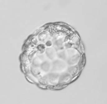 Embryo development Embryo