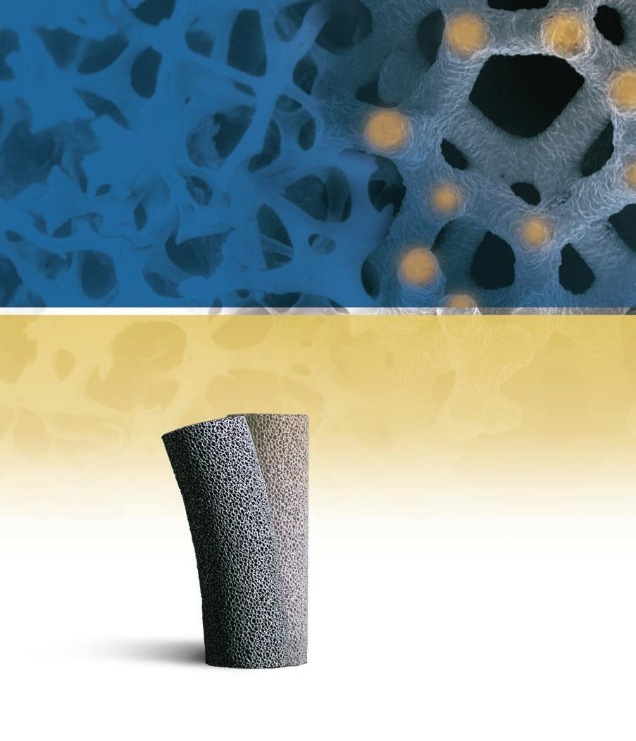 Porosity Fully interconnected pores and 75%-80% porosity allow approximately two to three times greater bone ingrowth than with conventional porous coatings and double the interface shear strength.