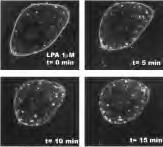 LPA is produced by activated platelets and has been implicated in wound healing and tissue remodeling. LPA levels are found elevated in ascitic fluid from ovarian cancer patients.