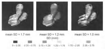 81 13 RADIOTHERAPY matic image acquisition such that an optimal image quality is obtained for any exposure. At a dose of 5 MU or less, the accelerator has no time to reach a constant output, i.e., all frames show an uneven exposure (with variations in intensity of up to 50% over the image area) due to image scanning.