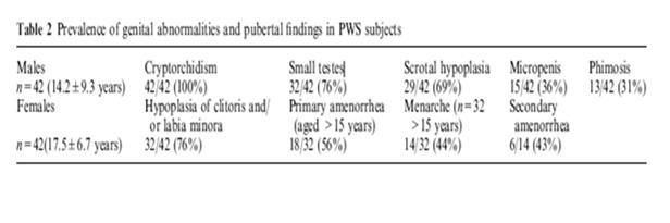 Hypogonadism in Males with PWS Prevalence of genital abnormalities and pubertal findings in PWS subjects (Crino et al, 2003) Hypogonadism in Males with PWS What about hcg?