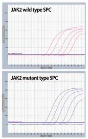 B-10. Human Genotyping AccuPower JAK2 V617F Quantitative PCR Kit The JAK2 (Janus Kinase 2) gene has been reported to be related to MPD (Myeloproliferative Disorder).