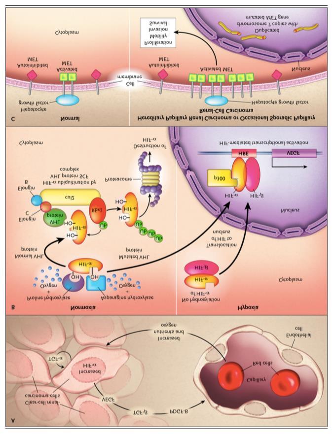 renal cell carcinoma 1. Herbert T.
