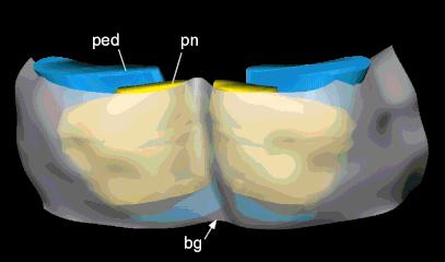 252 T.B. LEERGAARD ET AL. Fig. 4. Computer-generated surface model of the pons in a view from ventral.