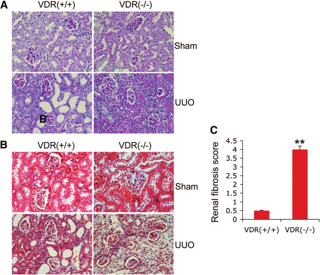 www.jasn.org BASIC RESEARCH Figure 1. VDR-null mice develop more severe renal fibrosis in UUO. VDR( / ) and VDR( / ) mice are subjected to sham-operation or UUO surgery and killed after 7 days.