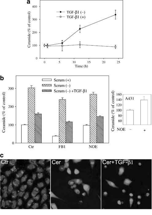520 MAPK and ceramide in TGF-b1-mediated antiapoptosis reduced the levels of phosphorylated forms of ERK1/ERK2 at an early stage, but showed no obvious effect after 2 h (Figure 5b).