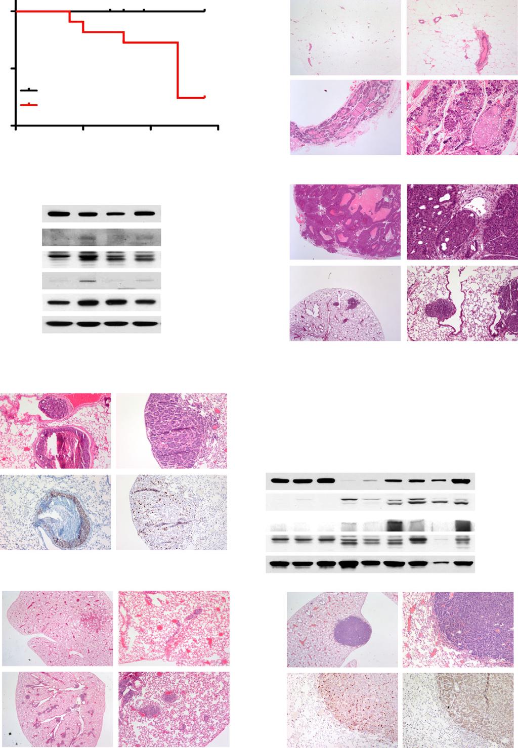 A C E H B D F G I Figure 3. mir-22 Induces Mammary Tumorigenesis and Metastasis In Vivo in Transgenic Mice (A) Cumulative disease-free survival analysis.