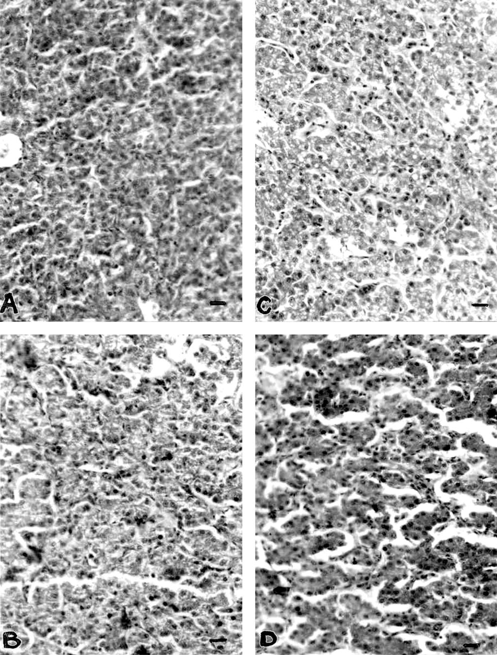 6 MIAZZO ET AL. FIGURE 3. Photomicrographs of hematoxylin and eosin stained liver sections of chicks fed with the following diets: A) control, 0.