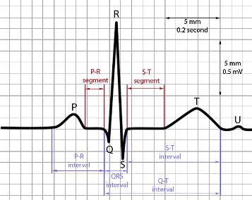 Fig 1: Normal Cardiac Cycle. [GOOGLE SOURCE] Normal ECG signal consists of P wave, QRS complex, T wave, U wave, PR segment, ST segment, PR interval and QT interval.