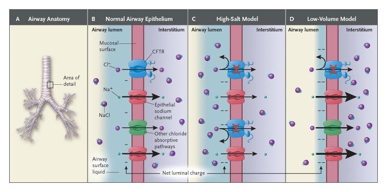 Models Explaining the Transepithelial Potential Difference across the Airway Epithelium in Cystic Fibrosis Rowe et al. N Engl J Med 2005;352:1992.