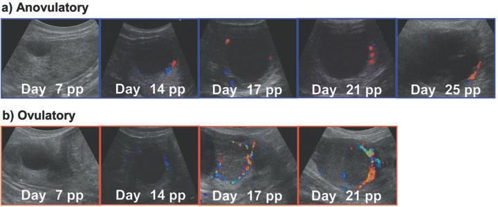 158 MIYAMOTO et al. Fig. 6. Images of developing follicles during the postpartum period. a) Anovulatory follicles grow to larger than ovulatory size but are associated with low estradiol production.