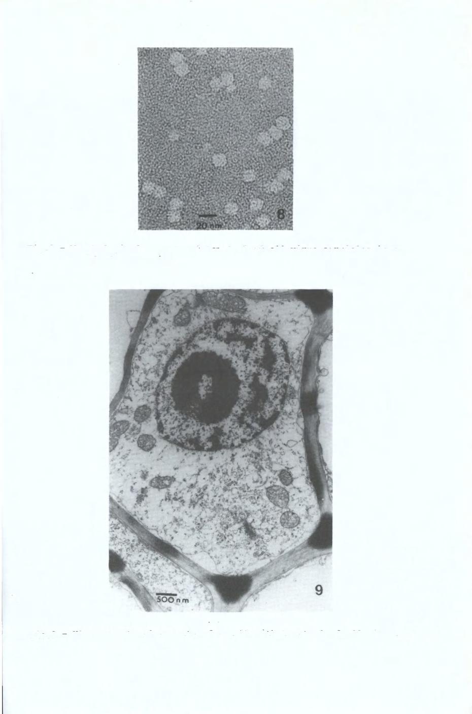 Fig.8 - Morphological aspects of tomato leafroll virus particles in a purified