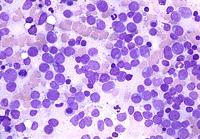 assessment of cellularity Multiple blood cell types and mature WBCs present Majority of