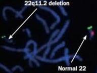 biological lineage and stage of differentiation Cytogenetics Cytogenetics: gene