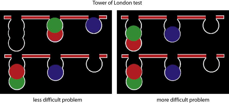 J.A. Grahn et al. / Progress in Neurobiology 86 (2008) 141 155 147 Fig. 2. The top part of the figure shows two trials from the computerised version of Tower of London task (Owen et al., 1990).