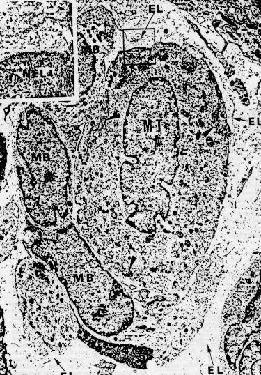 Damaged muscle fiber Satellite cells Skeletal muscle fibers from rat soleus muscle. A satellite cell (SC) is shown between the external lamina (EL) and sarcolemma (SL).