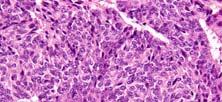 Differentiation: Immunohistochemistry A Synaptophysin Well