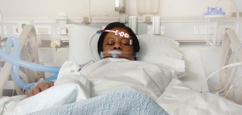 BIS Brain Monitoring for Critical Care The Bispectral Index (BIS ) is a processed EEG parameter that provides a direct measure of the effects of sedatives on the brain.