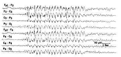 Oscillations from 1/sec to >100/sec.