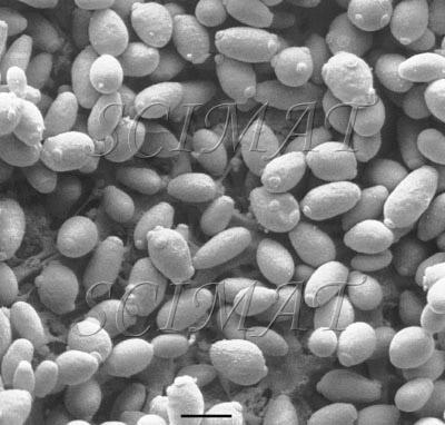 Yeasts Somewhat larger of the order of 20 µm. Most of them are spherical or ellipsoidal.