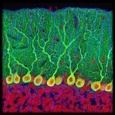 neurons Bipolar neurons - retina How