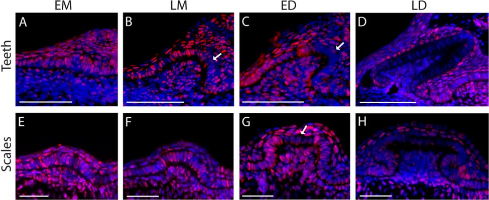 Debiais-Thibaud et al. BMC Evolutionary Biology (2015) 15:292 Page 10 of 17 epithelium (stage LM to LD) and transitorily in the mesenchyme at stage ED (Fig. 5e1-4).