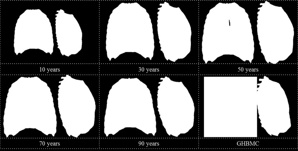 t RESULTS Select ages of the rib cage FE models illustrating the size and shape changes in both males and females are depicted in Figure 3 and Figure 4.