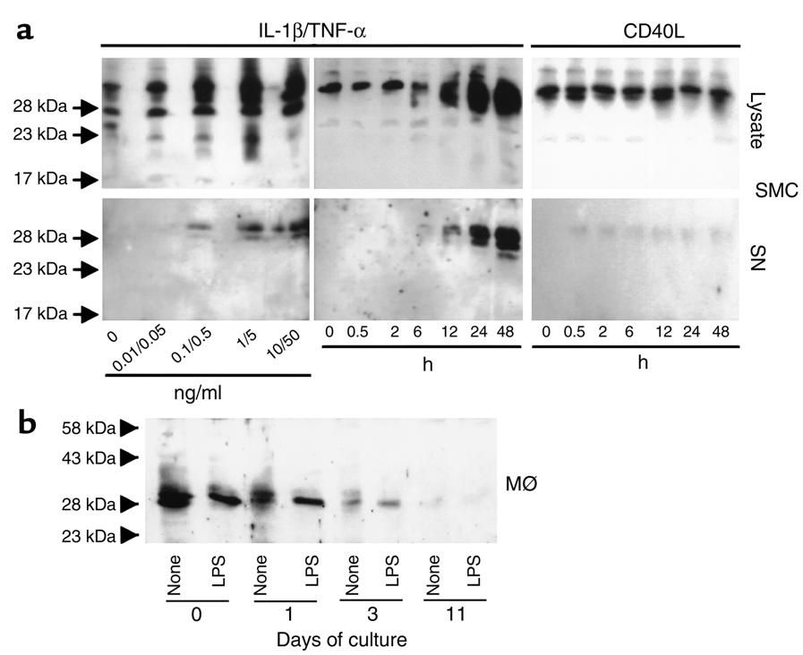 Results TFPI-2 inhibits MMP activity.