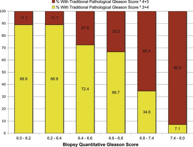 4 versus 4 þ 3 tumors, stratified by biopsy quantitative Gleason score. Figure 2.