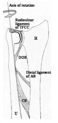 The Dorsal Oblique Bundle Distal 3 ligaments in constant tension during f/a rotation Dorsal oblique bundle (DOB) has continuity with fibers of TFCC DOB present in 40% population Possible secondary