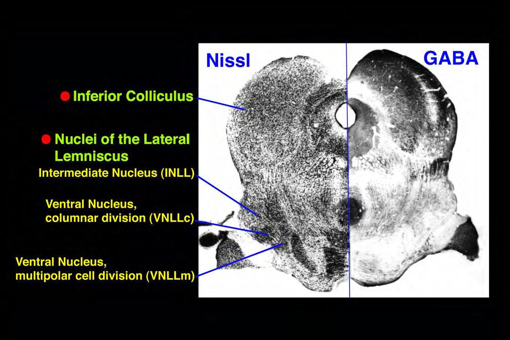 The Nuclei of the Lateral Lemniscus (NLL) are an important part of the pathway for analyzing