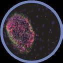 Embryoid bodies NPCs/NSCs (Nestin