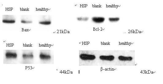 Apoptosis of HUVEC induced by IgA1 from HSP Table 3. Expression of Bcl-2, Bax and P53 mrna in HUVEC Group n bax Bcl-2 P53 Blank control 8 0.22±0.05 2.12±0.31 0.13±0.04 HSP 8 1.00±0.12** 1.00±0.11** 0.