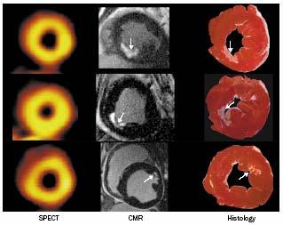 dogs with subendocardial infarcts Visible on DE-MRI