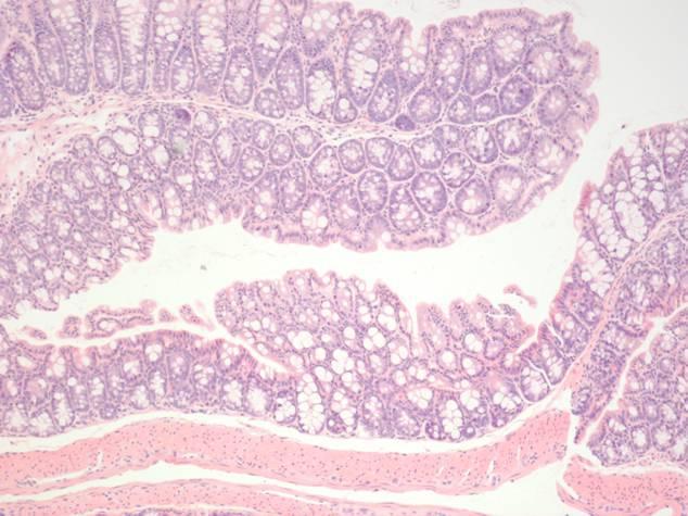 Lesions are chronic Therapeutic treatment model Histological features of human Crohn s disease