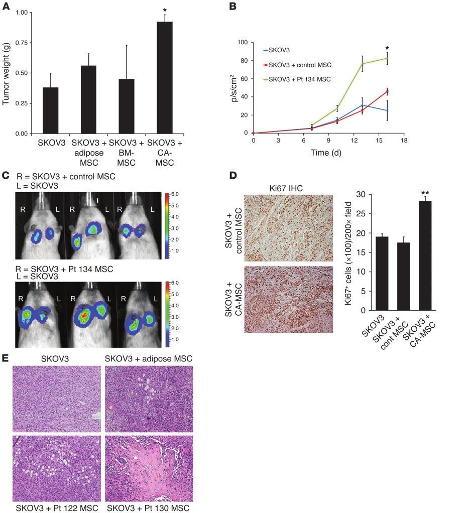 Figure 3 CA-MSCs promote ovarian tumorigenesis more than control MSCs.
