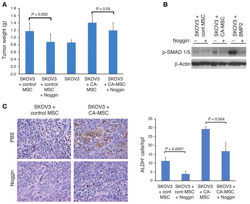 Figure 7 Noggin therapy abrogates MSC-mediated tumorigenesis with an associated decrease in ALDH + cells.