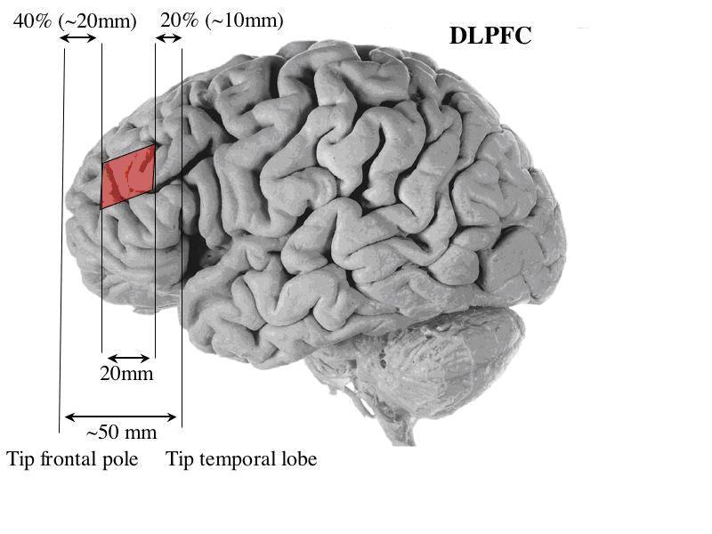 40% ( 20mm) 20% ( 40mm) 4, e* -- DLPFC Tip frontal pole Tip temporal lobe Figure 3. Boundary Rules to identify DLPFC (shaded area) 6.