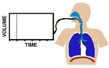 Spirometry Simple, office-based Measures flow, volumes