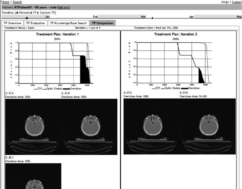 RT decision support system Image-assisted knowledge discovery and decision support in radiation