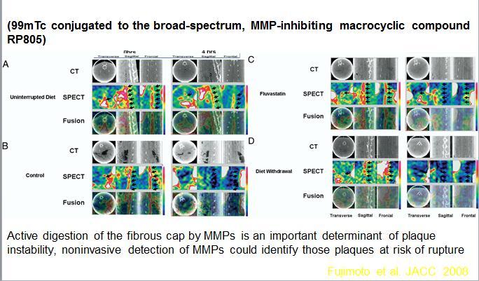 Molecular Imaging of Matrix Metalloproteinase in