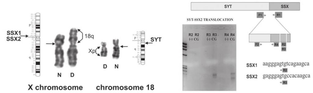 Table 1: Cytogenetic anomalies & corresponding molecular defects Tumor Cytogenetics Molecular Lesion Molecular Tests Ewing family tumors t(11;22)(q24;q12) EWS-FLI1 EWS-FLI1 FISH (2 color) (EFTs)