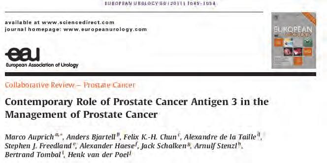 associated aggressiveness progression in AS PCA3 correlates with: Cancer vol > 0.