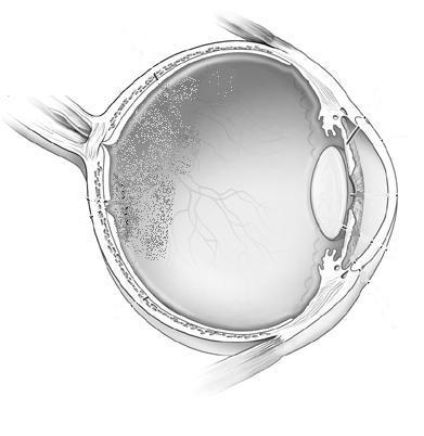 vitreous humour retina fovea centralis optic